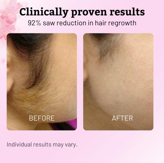 Caramela Hair Removal Oil